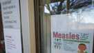 Measles outbreak in West Texas: Unvaccinated child dies