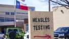 As measles cases mount in the US, what’s the situation worldwide?